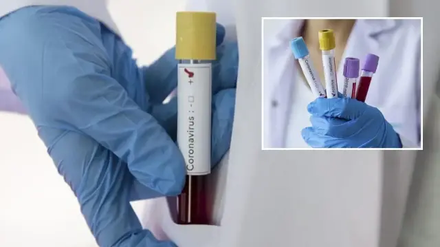 zayiflar kovid 19u daha agir geciriyor PpYukJMi.webp